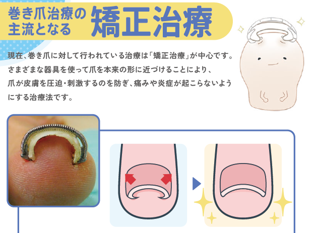 施術情報と費用